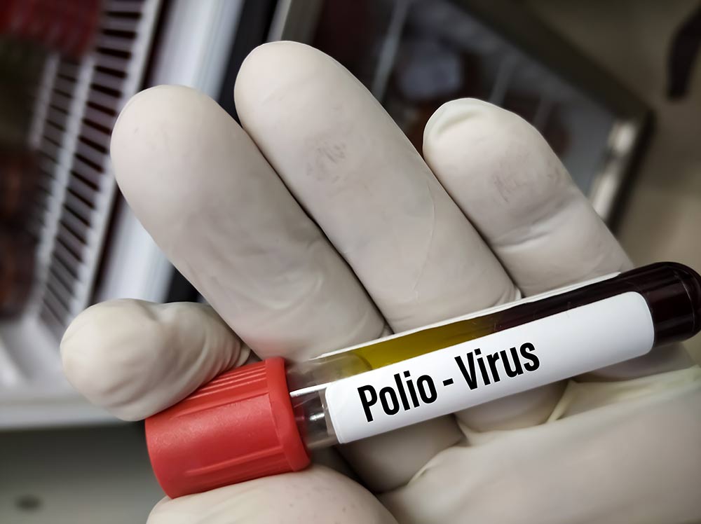 Cara Mencegah Penyakit Polio