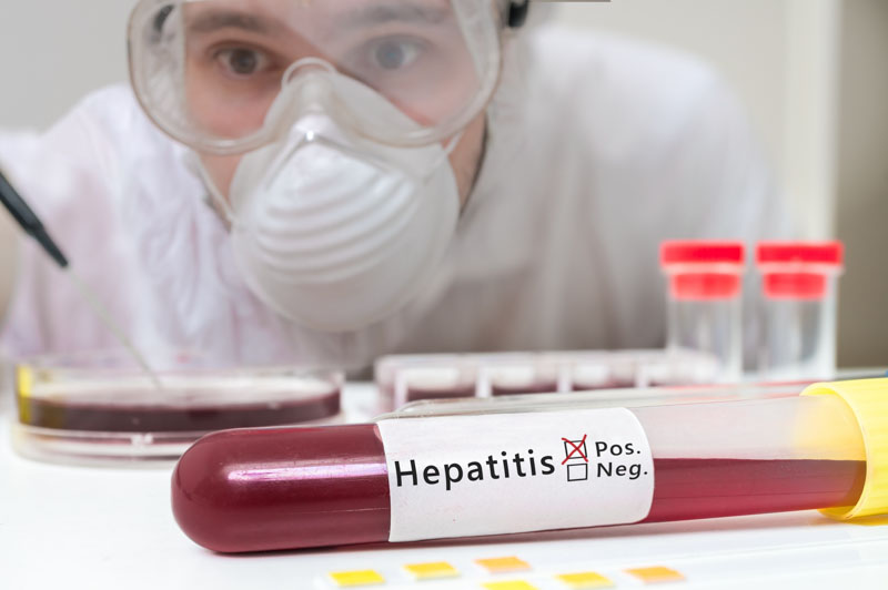 Sakit Perut Sebelah Kanan Bisa Menjadi Gejala Hepatitis